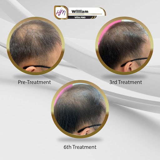 Klinik Rambut Terbaik Near Me di Butterworth