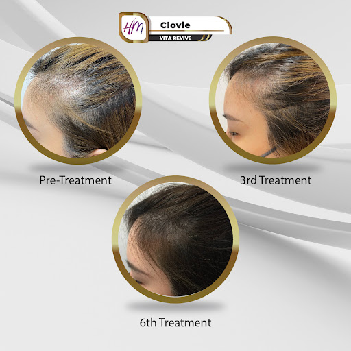 Klinik Rambut Terbaik Near Me di Puchong untuk Rawatan Profesional