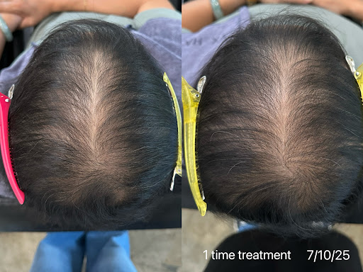 Klinik Rambut Terbaik Near Me di Sungai Pelek New Village